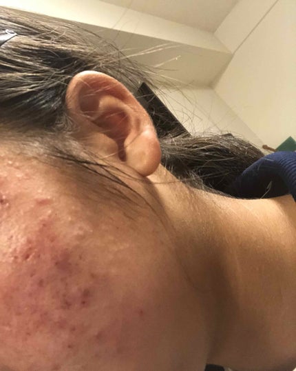 ハトムギ化粧水(ナチュリエ スキンコンディショナー R )/ナチュリエ/化粧水を使ったクチコミ(4枚目)