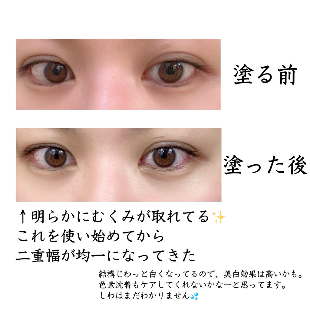 ブルーブラッド、韓国シミ消しゴム アクセンダ　ルティナー 毛穴バーム ピーリング セラムフィット バランシング トーンアップクリーム＜化粧下地