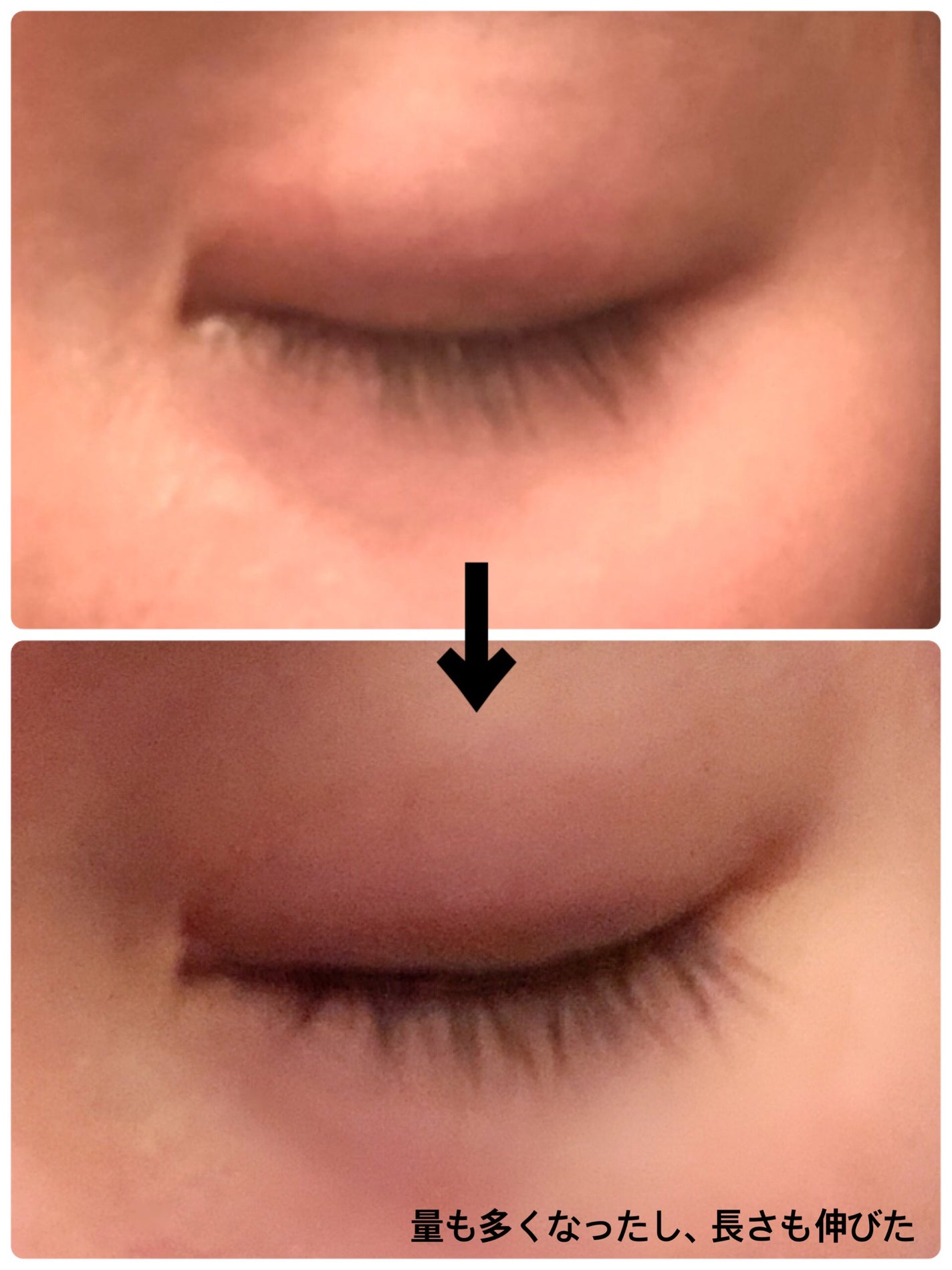 エグータム/アルマダスタイル/まつげ美容液を使ったクチコミ(3枚目)