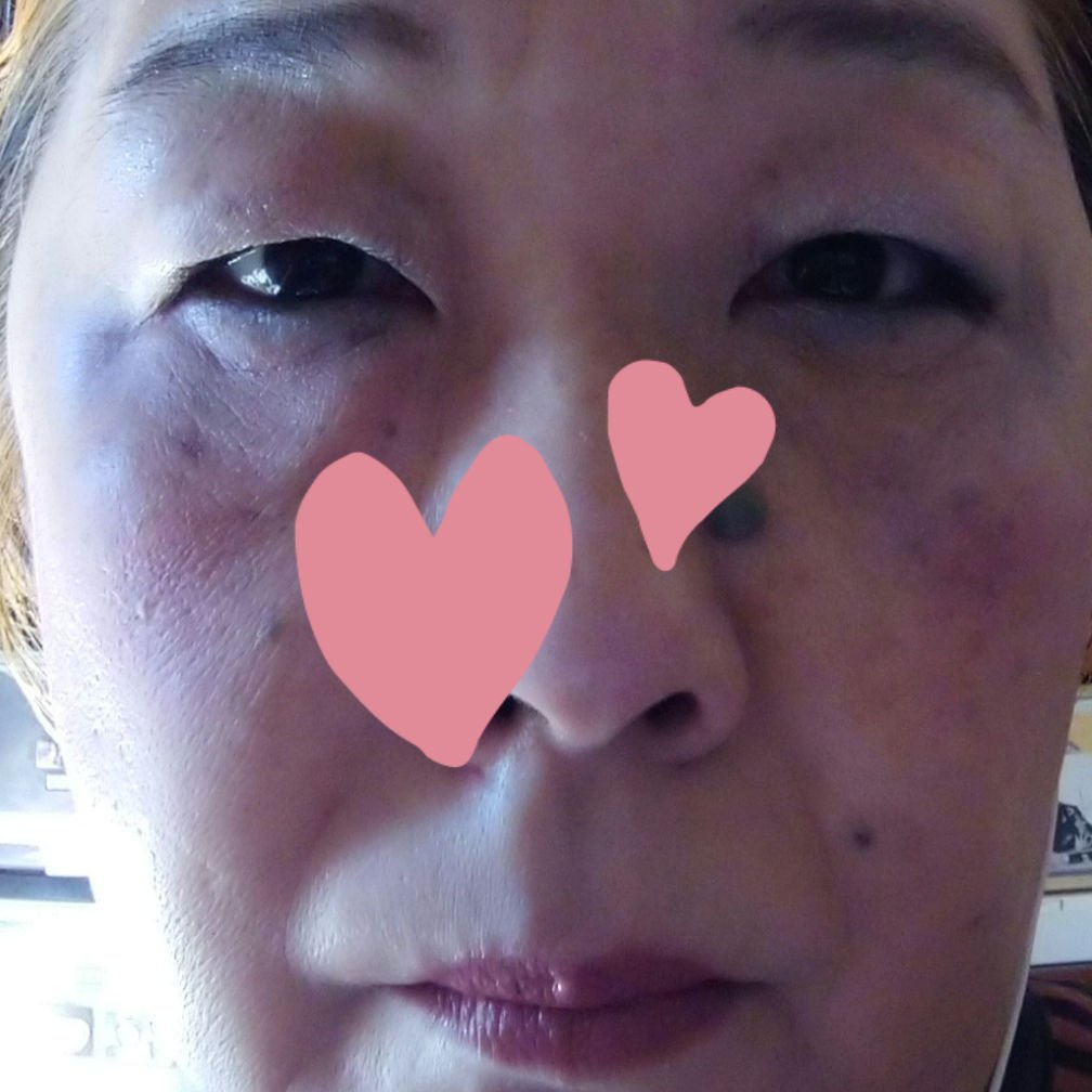 フィットミー リキッド ファンデーション DN 112/MAYBELLINE NEW YORK/リキッドファンデーションを使ったクチコミ（3枚目）