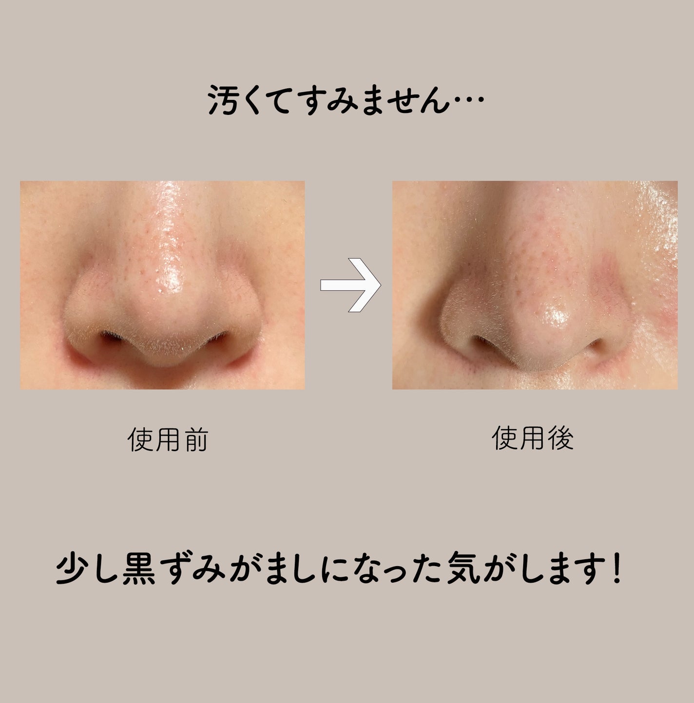 マイルドクレンジング オイル〈ブラック&スムース〉/ファンケル/オイルクレンジングを使ったクチコミ(2枚目)