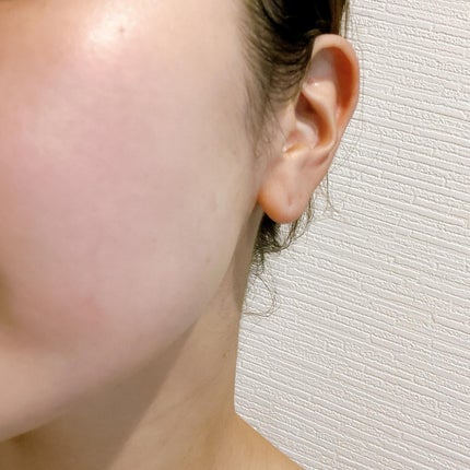 ルルルン ハイドラ V マスク/ルルルン/シートマスク・パックを使ったクチコミ(6枚目)