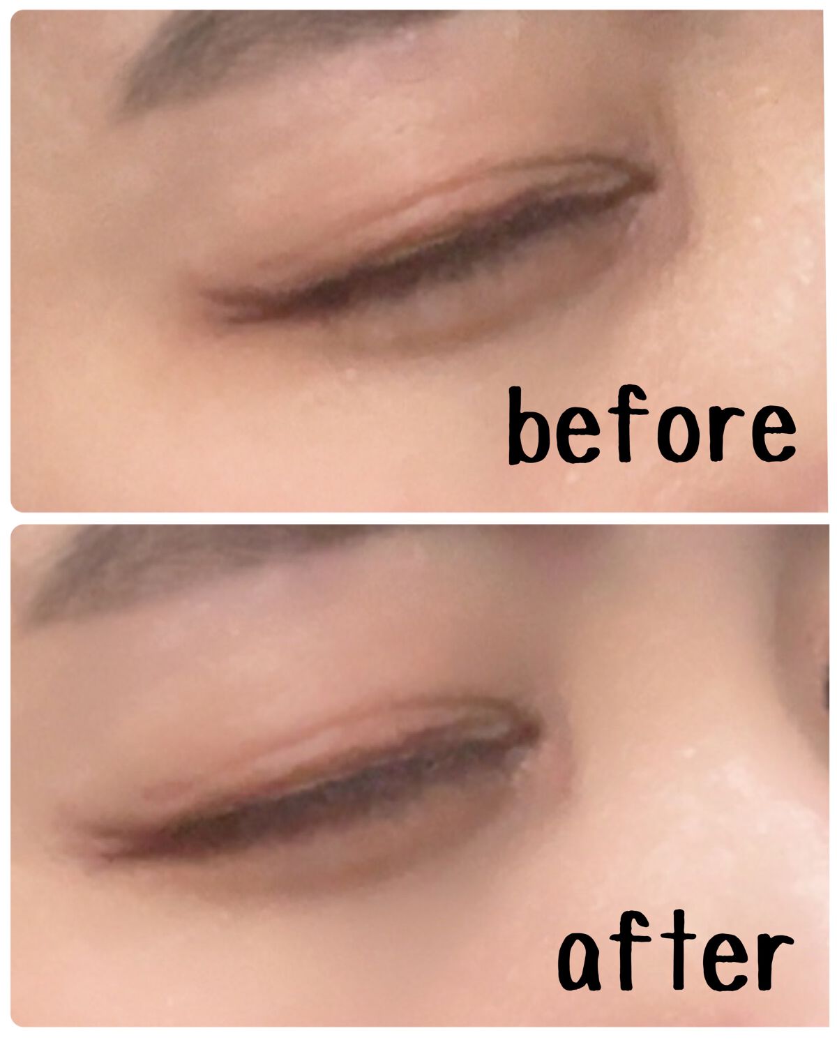 アイキララII/北の快適工房/アイケア・アイクリームを使ったクチコミ(5枚目)