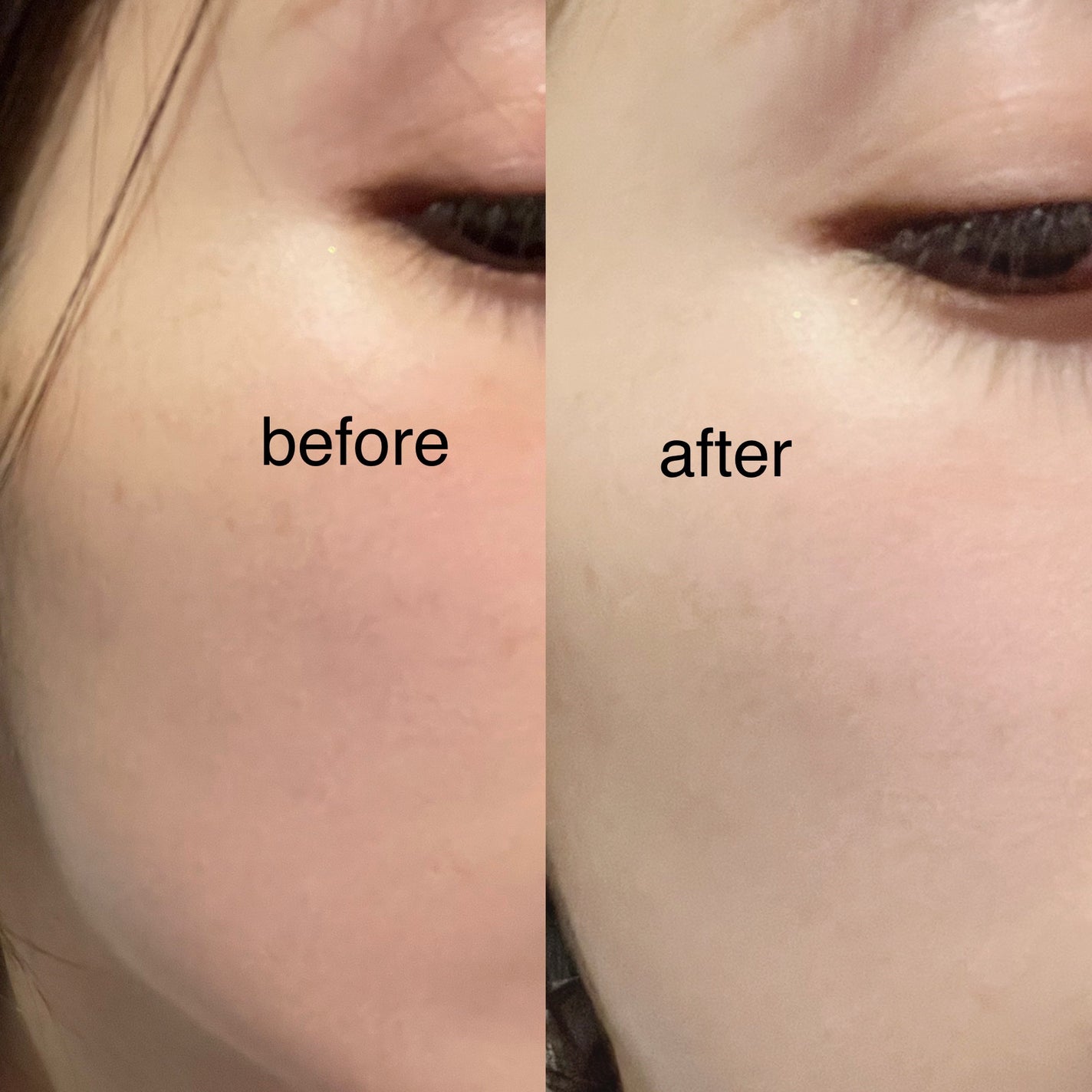 バイオ コンディショニング エッセンス/IOPE/ブースター・導入液を使ったクチコミ(2枚目)