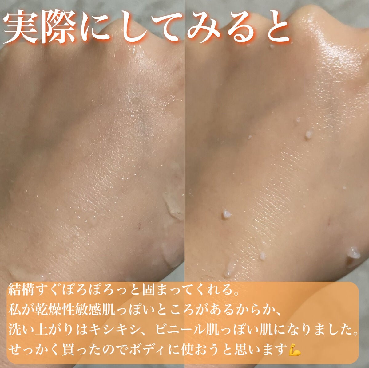 DETクリア ブライト&ピール ピーリングジェリー<ミックスフルーツの香り>/Detclear/ピーリングを使ったクチコミ(4枚目)