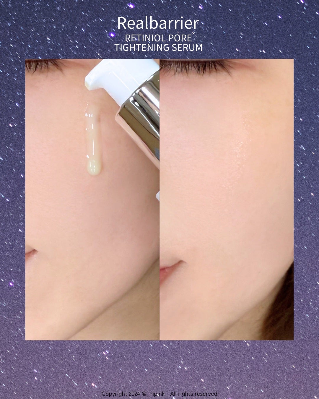レチ二オールポアタイトニングセラム/Real Barrier/美容液を使ったクチコミ(4枚目)