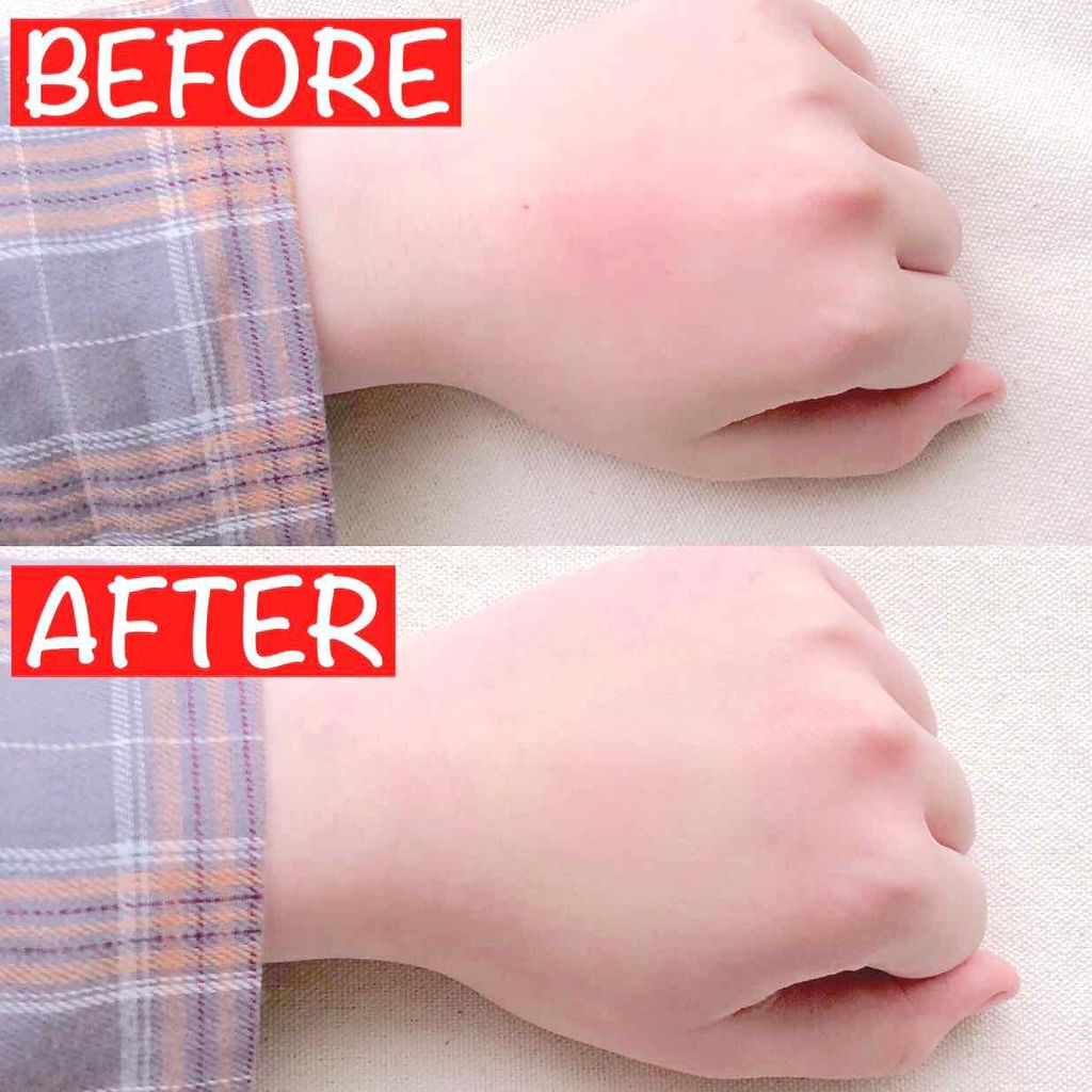 ハイブリッドカバーコンシーラー/LB/リキッドコンシーラーを使ったクチコミ（2枚目）