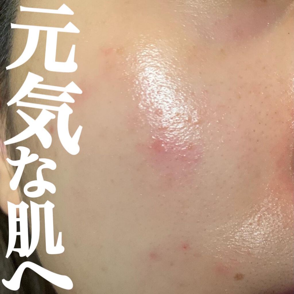 薬用しみ対策 美白化粧水 しっとりタイプ/メラノCC/化粧水を使ったクチコミ(1枚目)