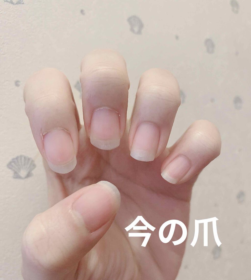ウィンマックス キューティクルオイル/DAISO/ネイルオイル・トリートメントを使ったクチコミ（2枚目）