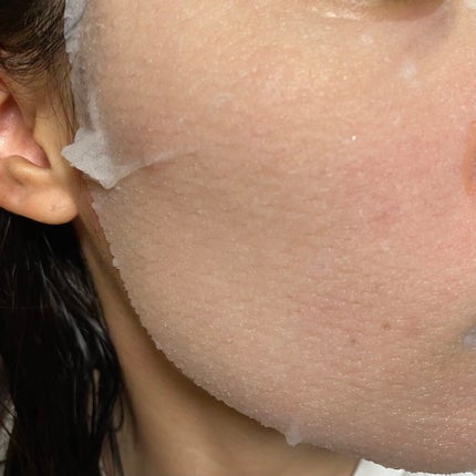 毛穴小町マスク /クリアターン/シートマスク・パックを使ったクチコミ(2枚目)