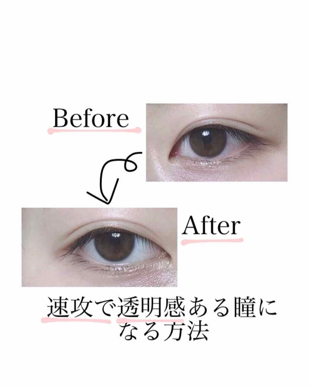 スマイルホワイティエ(医薬品)/ライオン/その他を使ったクチコミ（1枚目）