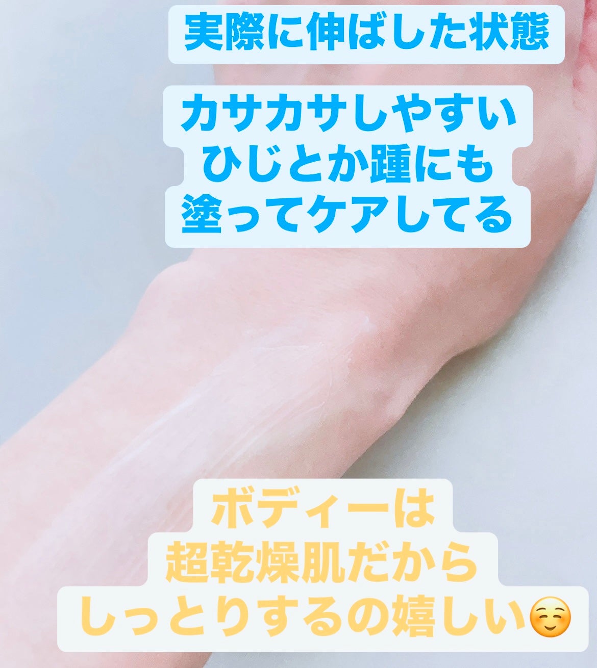 モイスチャライジングローション/セタフィル/ボディローションを使ったクチコミ(3枚目)