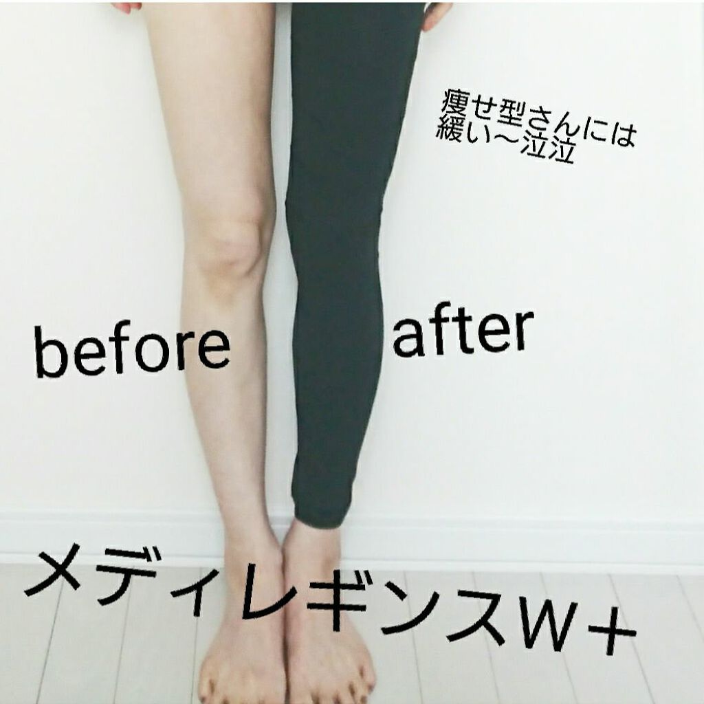 メディレギンス W＋/ラブリーラボ/着圧ソックス・レギンスを使ったクチコミ（1枚目）