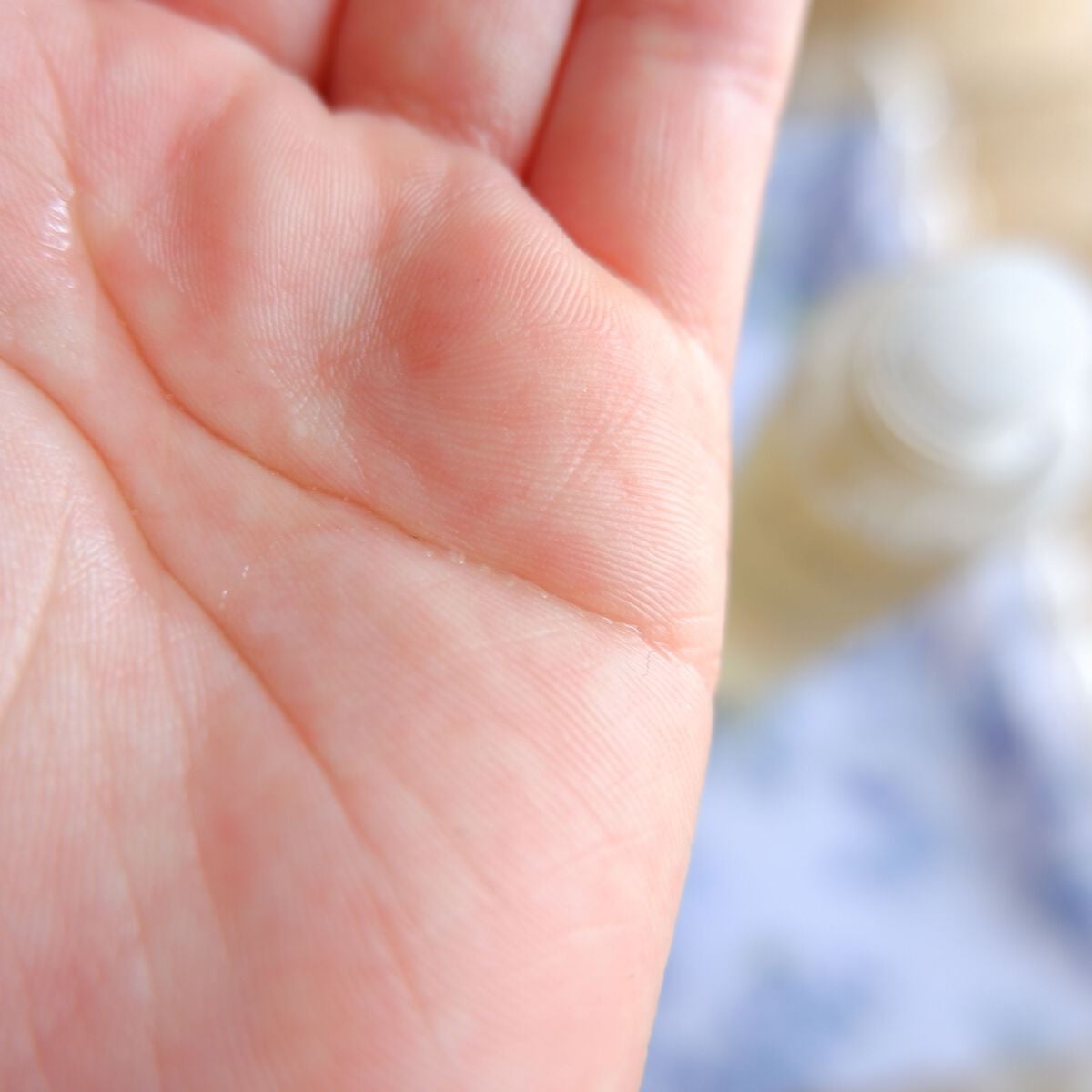 アンティア モイストバランサー/ドクターベルツ/化粧水を使ったクチコミ(3枚目)