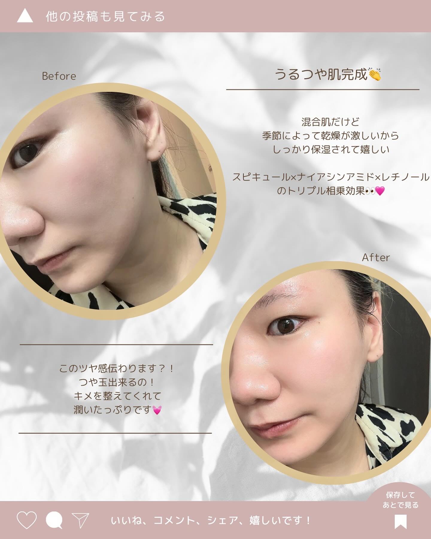 スピキュールシートマスク100/Twenties On/シートマスク・パックを使ったクチコミ（3枚目）