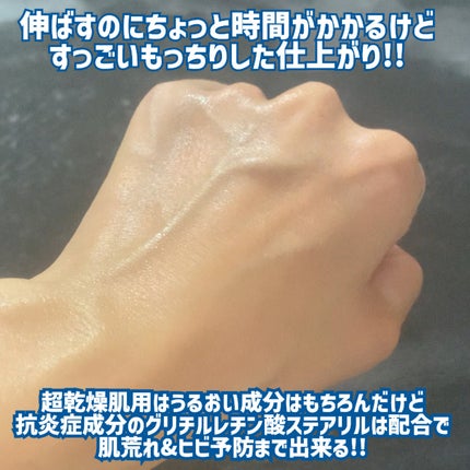 ニベア リペアエキスパート 薬用エクストラボディミルク 超乾燥肌用/ニベア/ボディミルクを使ったクチコミ(6枚目)