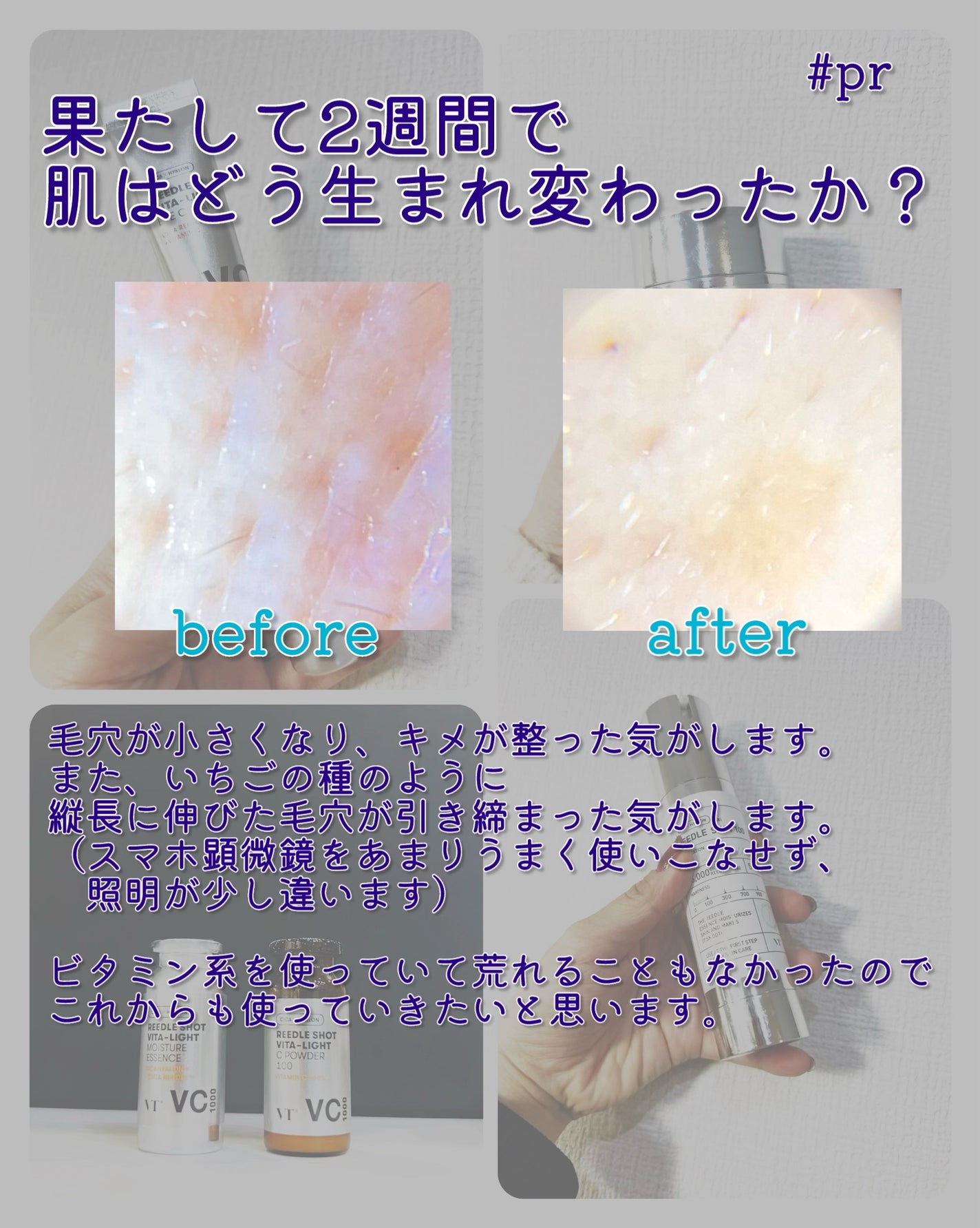 リードルショット100/VT/美容液を使ったクチコミ(6枚目)