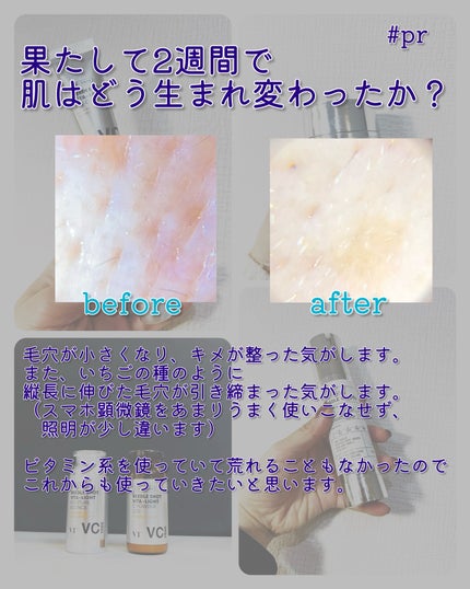 リードルショット100/VT/美容液を使ったクチコミ(6枚目)