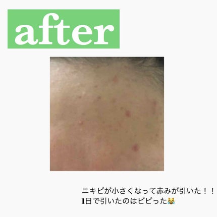 艶肌ドロップ/ラッシュ/美容液を使ったクチコミ(4枚目)