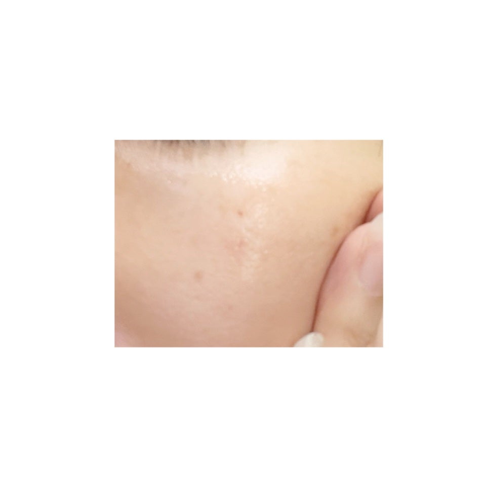 メラノフォーカスEV/HAKU/美容液を使ったクチコミ(6枚目)