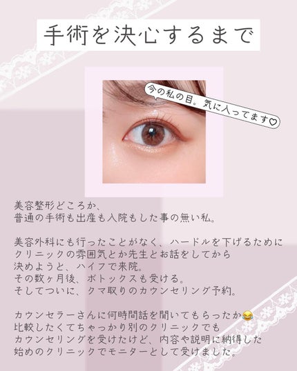 ぴーちゃん🧡インスタでコメント返信 on LIPS 「クマ取り体験談/┈┈┈┈┈┈┈┈┈┈ストーリーズにダウンタイム..」(3枚目)