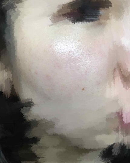 ハトムギ化粧水(ナチュリエ スキンコンディショナー R )/ナチュリエ/化粧水を使ったクチコミ(2枚目)