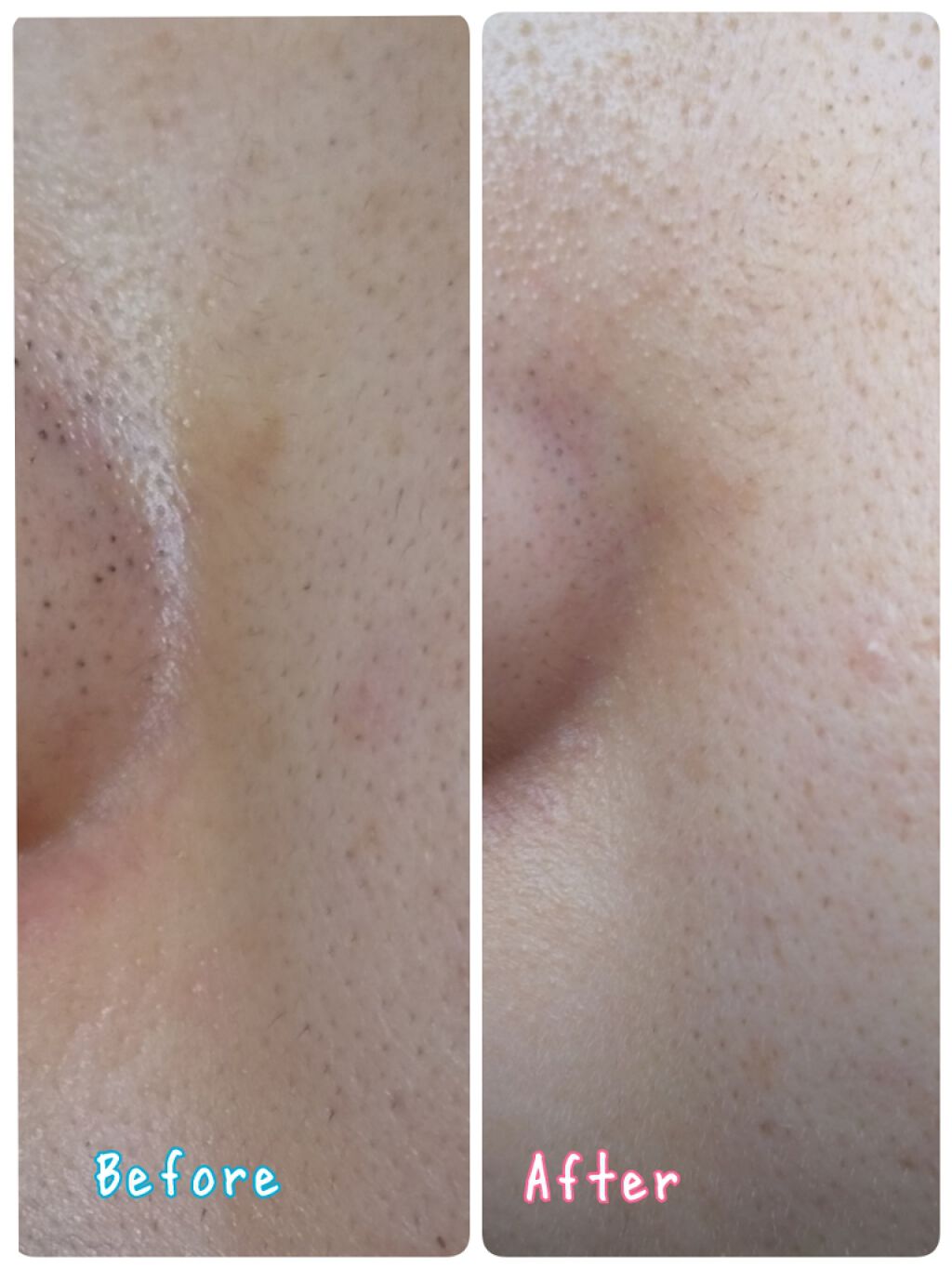 デュオ ザ クレンジングバーム クリア/DUO/クレンジングバームを使ったクチコミ(3枚目)