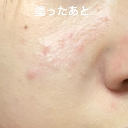 ワンリスト オールインワン デイクリーム/ナリスアップ/オールインワン化粧品を使ったクチコミ(9枚目)