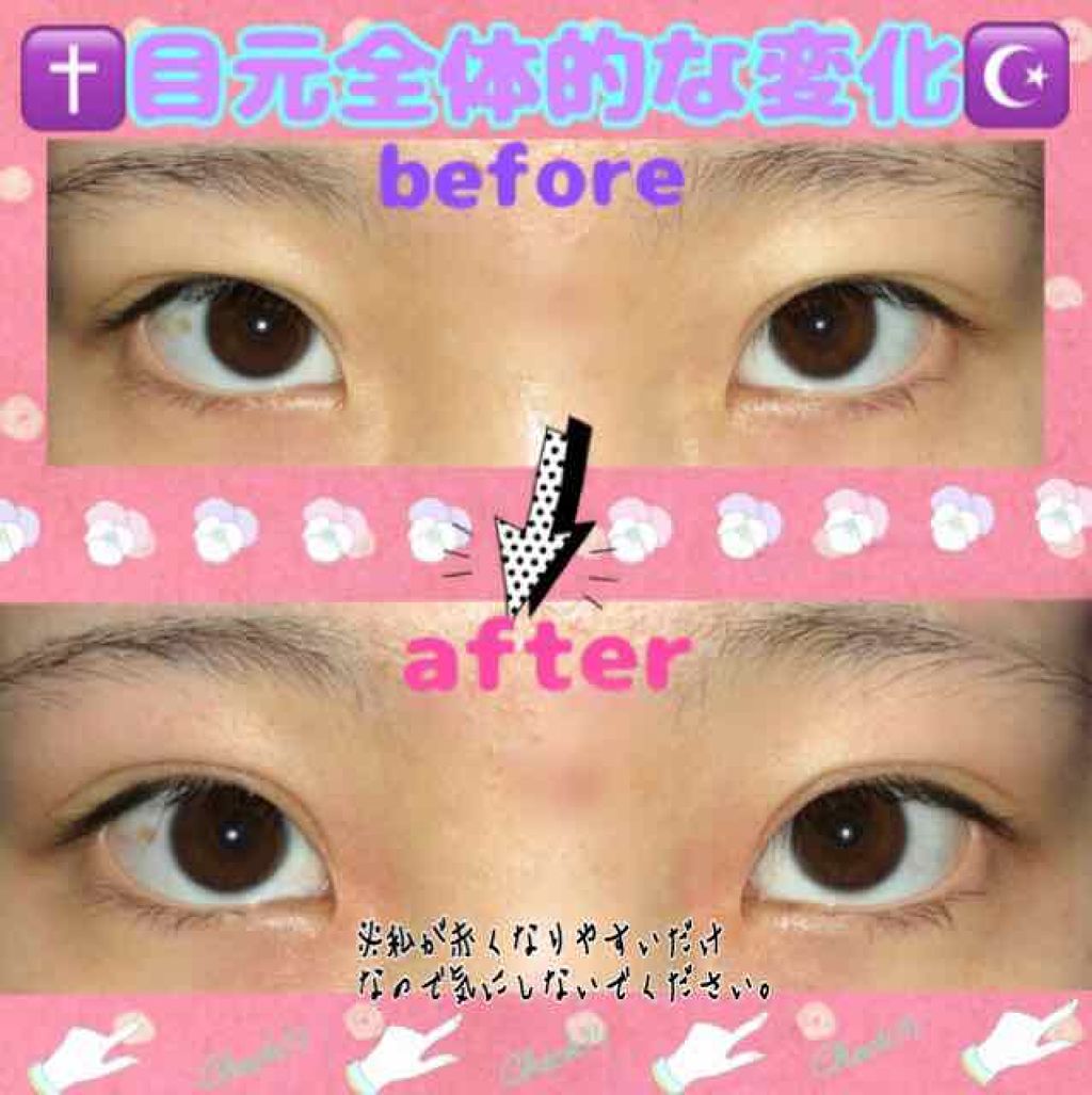 ニベアクリーム/ニベア/ボディクリームを使ったクチコミ（3枚目）