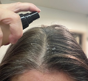 薬用育毛剤/マイナチュレ/頭皮ローションを使ったクチコミ（3枚目）