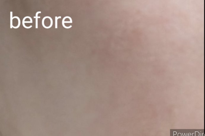 Derma Lift Mask/ALLUDEM/スキンケアキットを使ったクチコミ（3枚目）