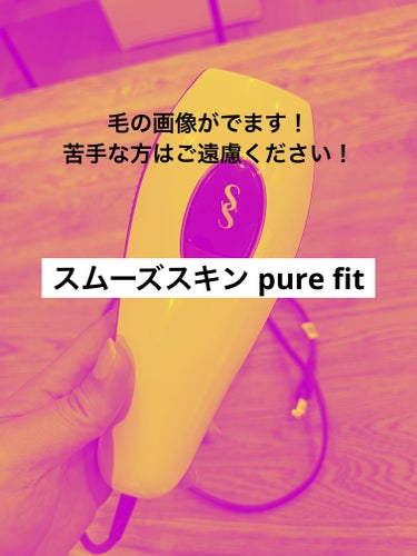 スムーズスキン スムーズスキン pure fitのクチコミ「スムーズスキン pure fit

4ヶ月間、毎週1回お家で施術しました。

脱毛効果として
.....」（1枚目）