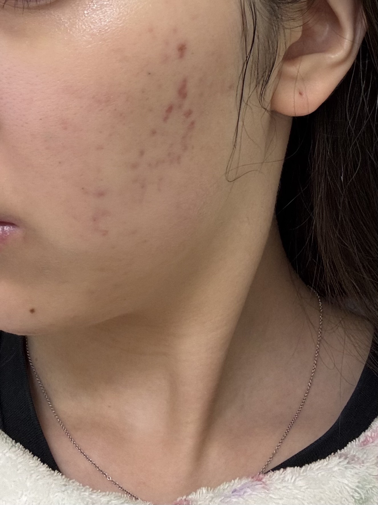 浸透湿潤セラミド１０％★ナノエマルジョン/TOUT VERT/乳液を使ったクチコミ（2枚目）