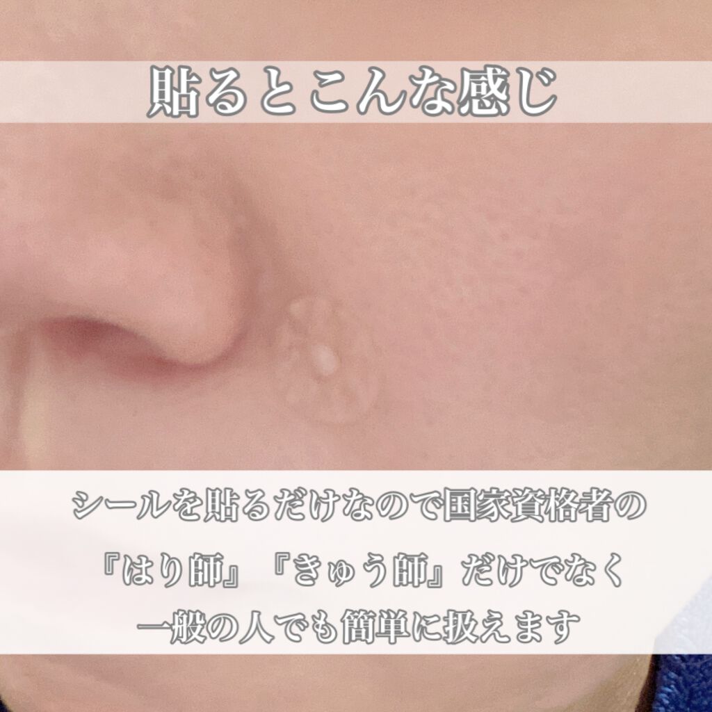 美容鍼シール/セイリン/その他を使ったクチコミ（3枚目）