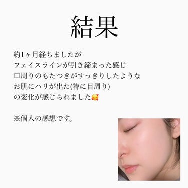 美容マニアなっちゃん on LIPS 「こんばんは🌙美少女戦士なっちゃんです💓今回はたるみケアの美容医..」（6枚目）