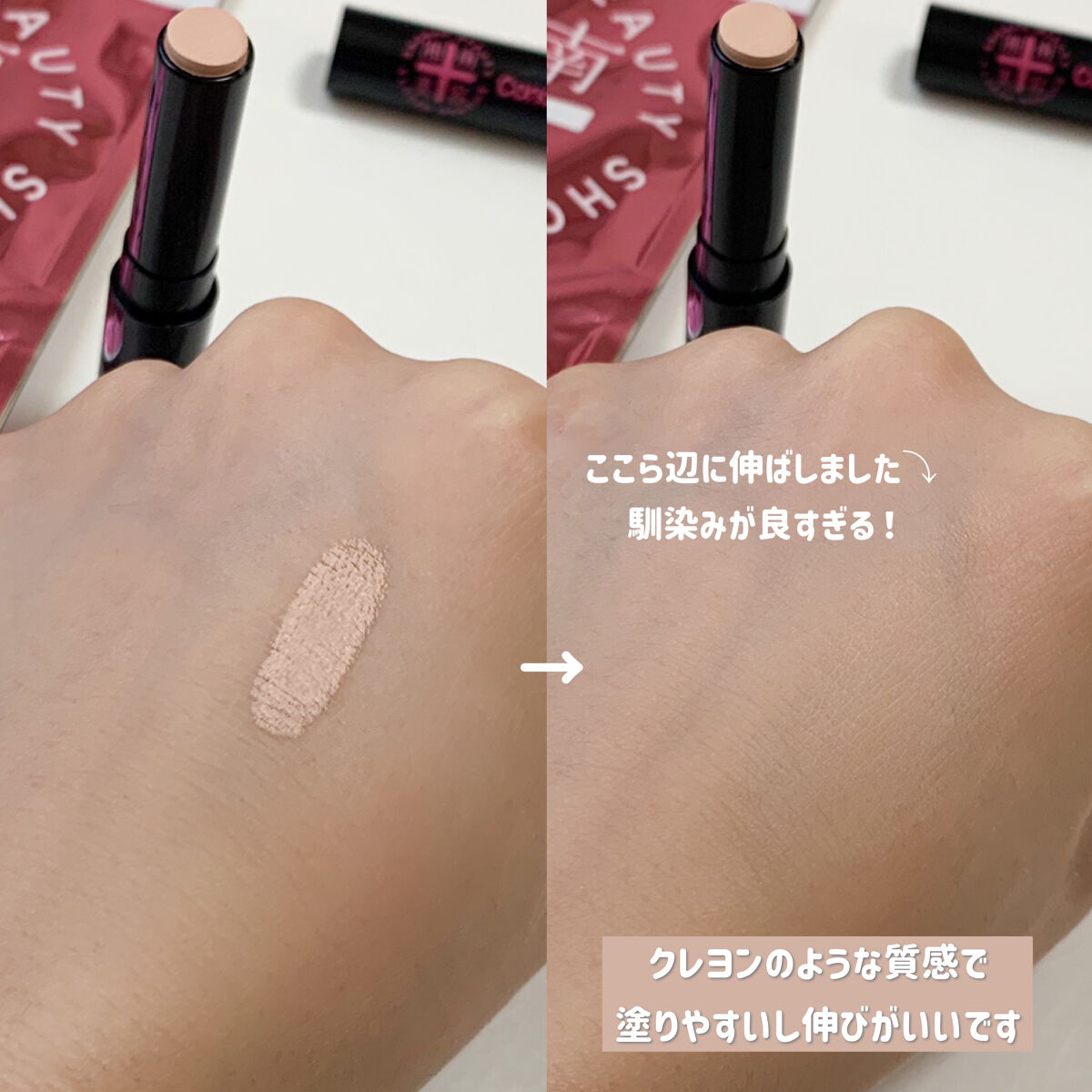 湘南美容コンシーラー/湘南美容/スティックコンシーラーを使ったクチコミ（2枚目）