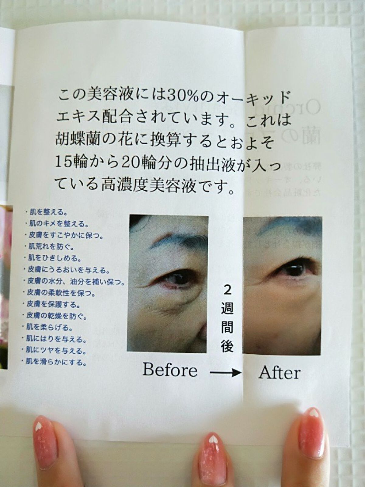 アンナララティ美容液/椎名洋ラン園/美容液を使ったクチコミ(3枚目)