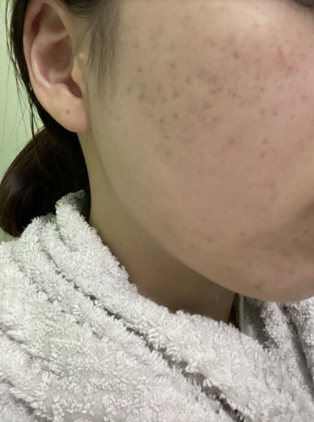 ブライト＆バウンシングローション（ノーマルタイプ）/ジュレリッチ/化粧水を使ったクチコミ（1枚目）