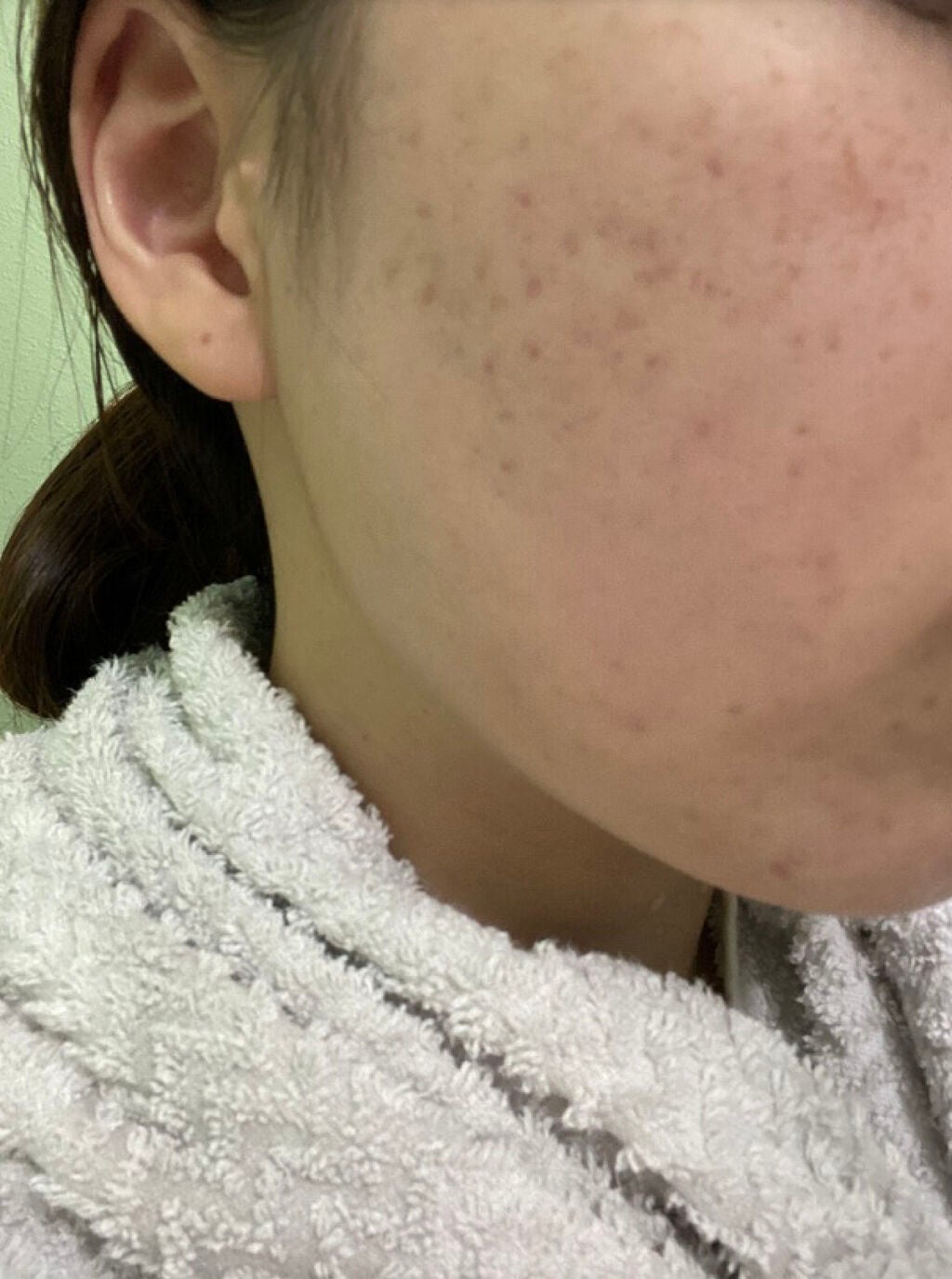 メディカルクリームG(薬用クリームG)/メンターム/ハンドクリームを使ったクチコミ(1枚目)