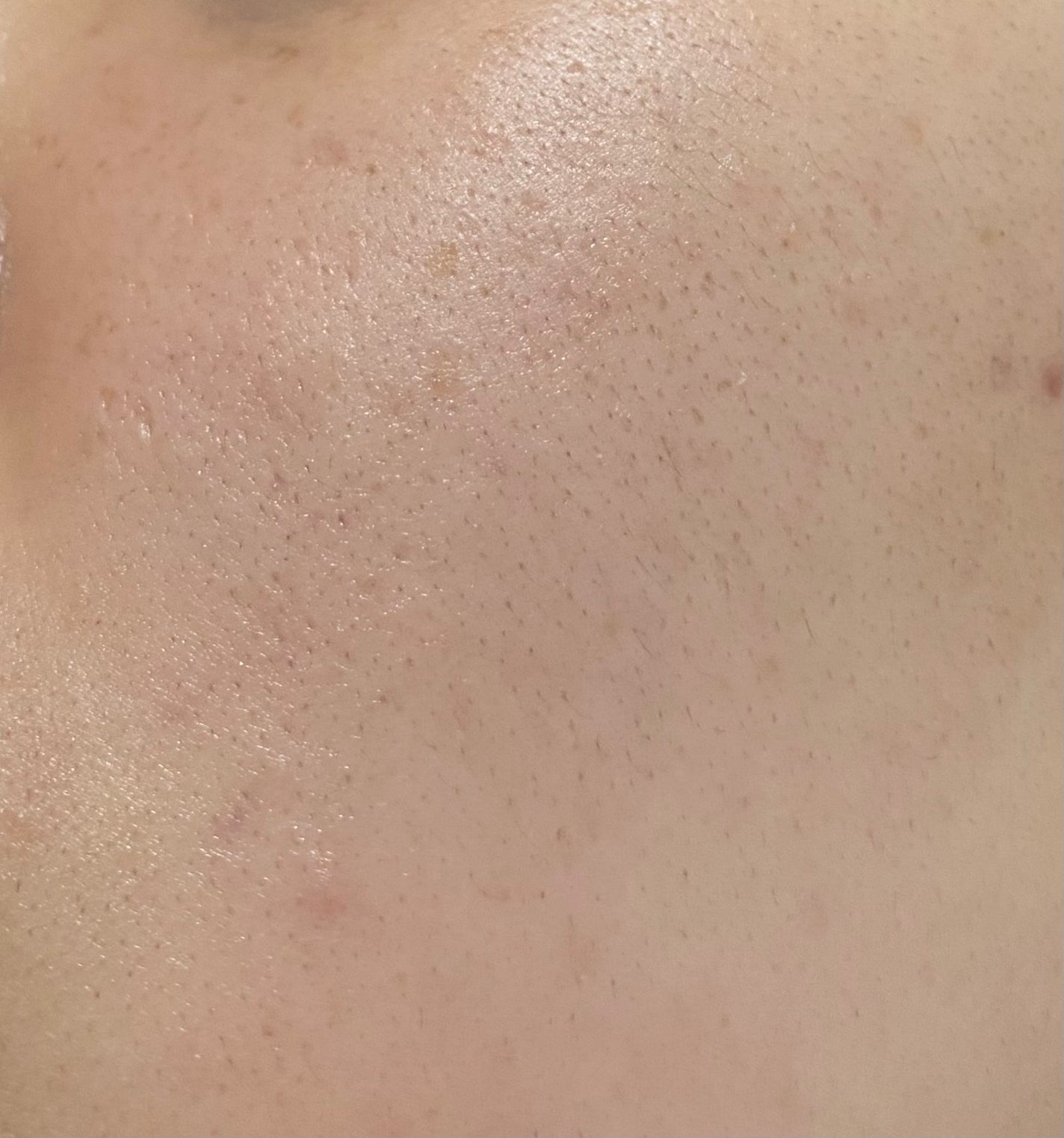 è¬çšWãã¯ã€ããšãã»ã³ã¹/éæçœè/çŸå®¹æ¶²ã䜿ã£ãã¯ãã³ãïŒ2æç®ïŒ