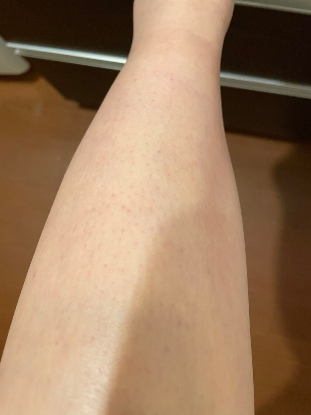 ブラウンシルクエキスパート (光美容器)/ブラウン/家庭用脱毛器を使ったクチコミ(5枚目)