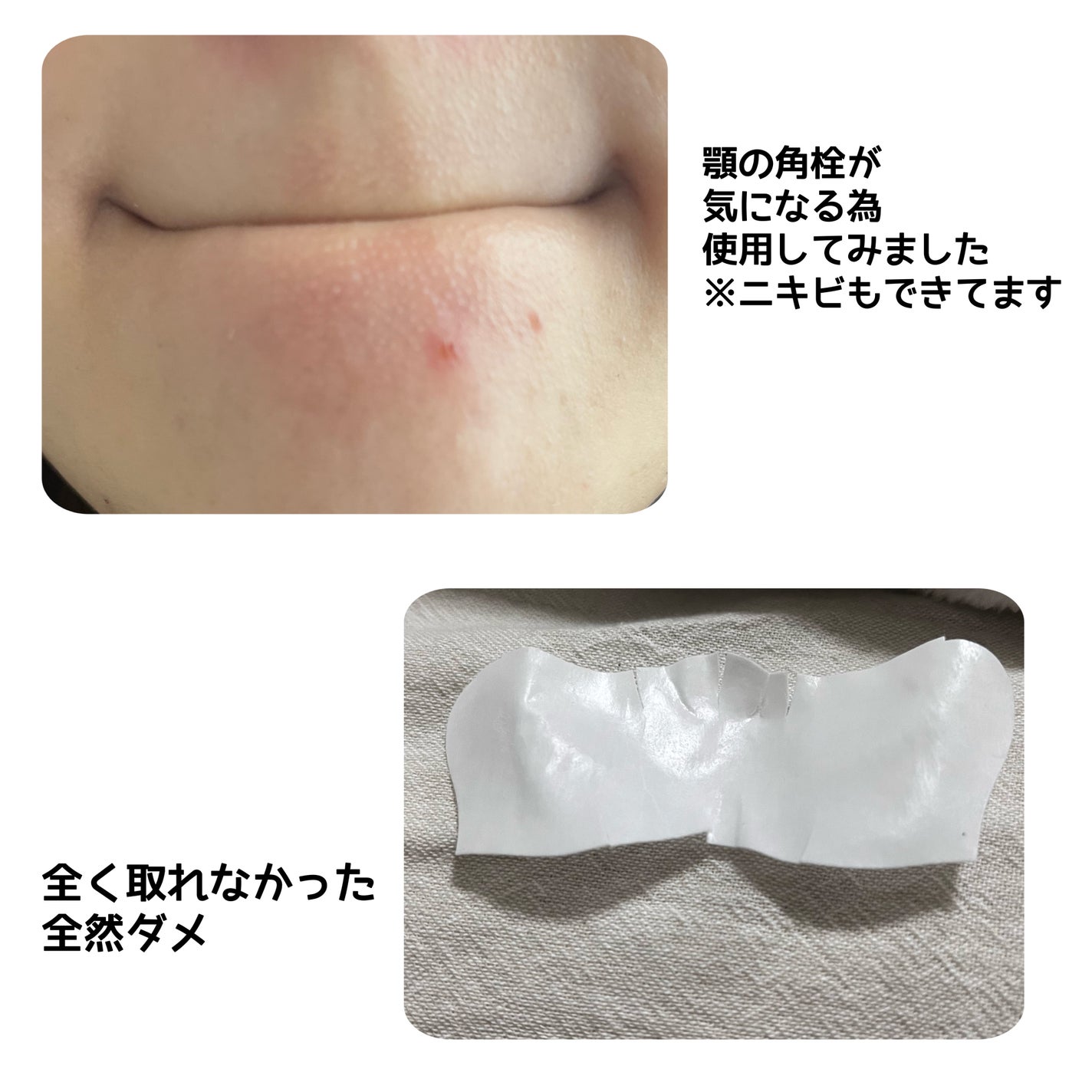 毛穴すっきりパック 鼻用 白色タイプ/ビオレ/その他スキンケアを使ったクチコミ(3枚目)