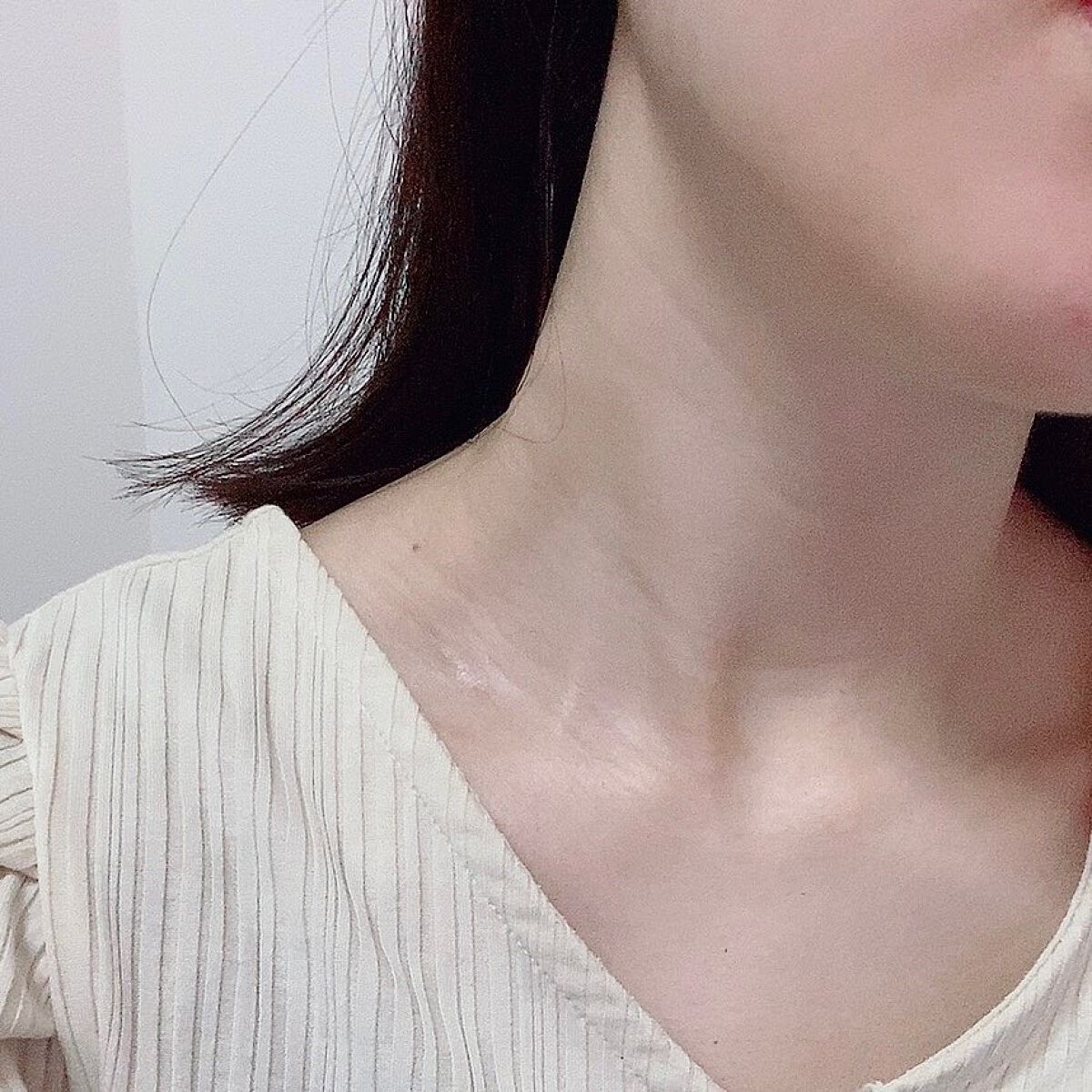 薬用ホワイトコンク ホワイトニングCC CII/ホワイトコンク/ボディクリームを使ったクチコミ(5枚目)