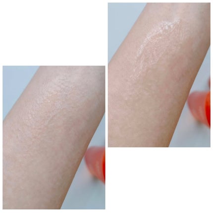 VC100エッセンスローション EX/ドクターシーラボⓇ/化粧水を使ったクチコミ(5枚目)