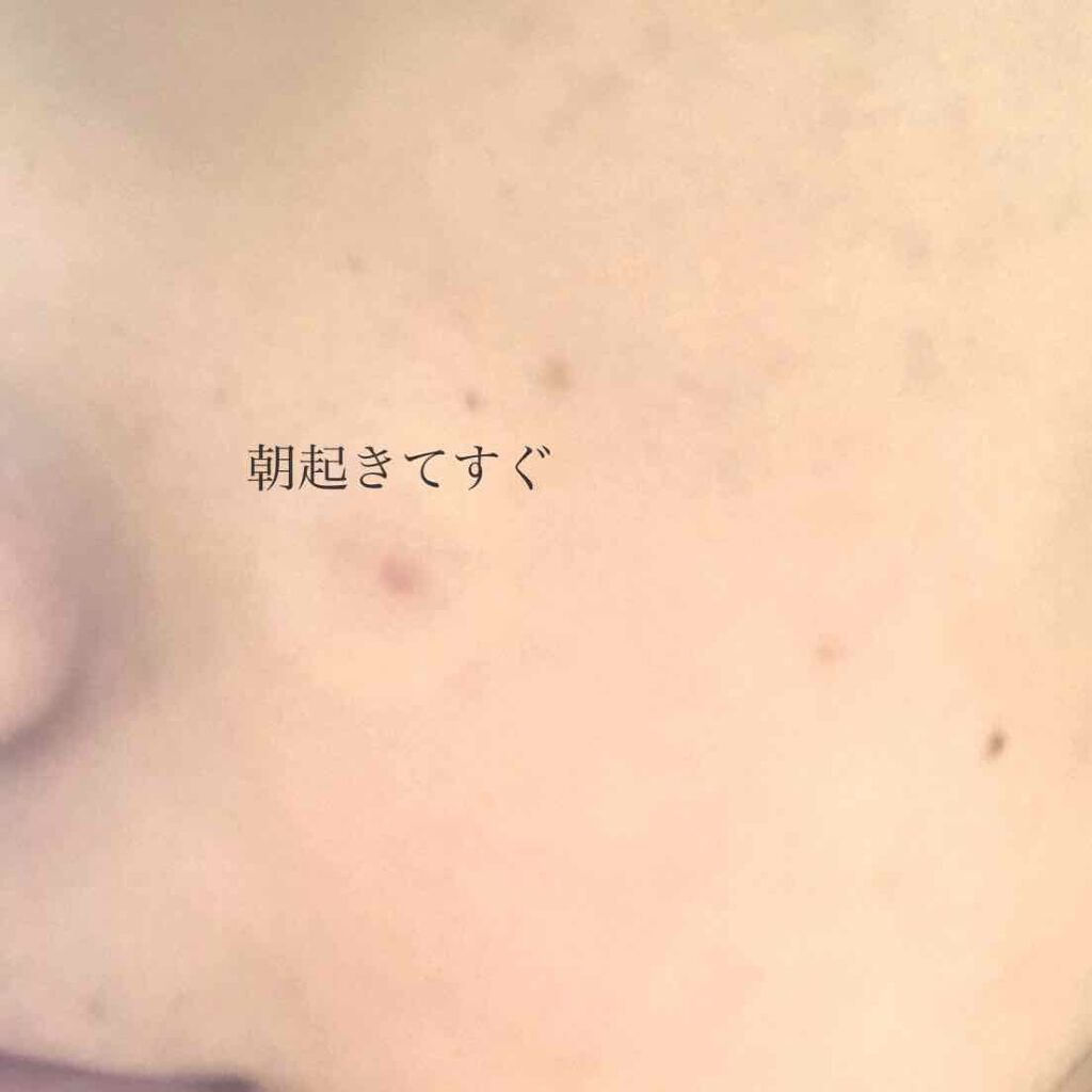 トラブルキュア/美肌ファクトリー/シートマスク・パックを使ったクチコミ(3枚目)