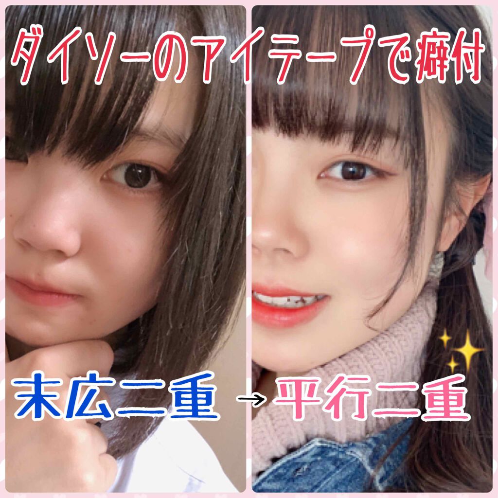 のびーるアイテープ(絆創膏タイプ、レギュラー)/DAISO/二重まぶた用アイテムを使ったクチコミ(1枚目)