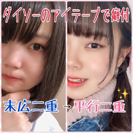 のびーるアイテープ(絆創膏タイプ、レギュラー)/DAISO/二重まぶた用アイテムを使ったクチコミ(1枚目)