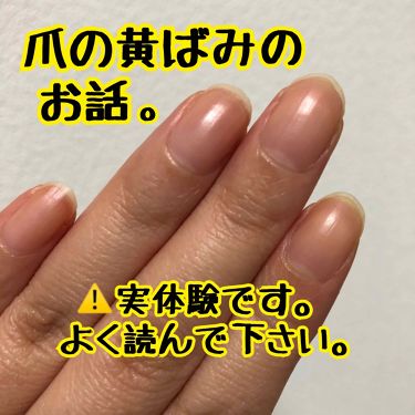 ベース コート ちふれの口コミ 爪の黄ばみのお話です 怖くなったので 調 By Gaho がほ 敏感肌 Lips