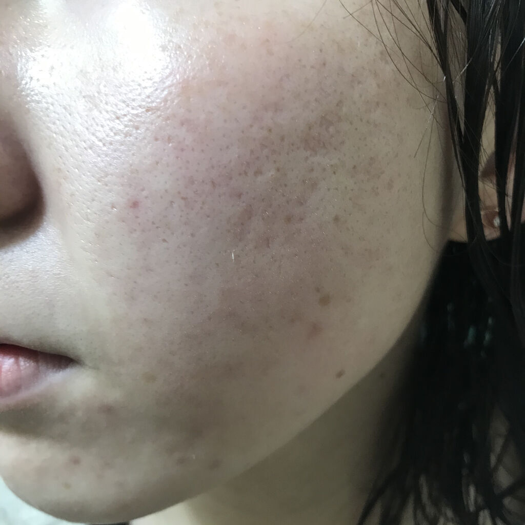 ティーツリーケア ソリューション エッセンシャルマスクEX/MEDIHEAL/シートマスク・パックを使ったクチコミ（2枚目）