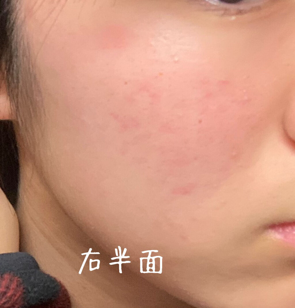 肌色コントロール 化粧下地/エルシア/化粧下地を使ったクチコミ（3枚目）